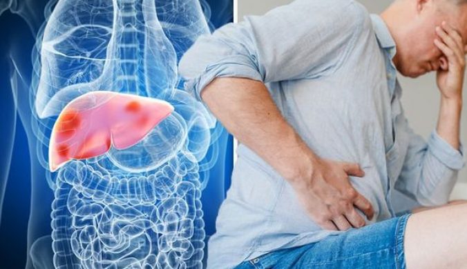 Liver-disease-symptoms